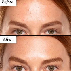 A+ High-Dose Retinoid Serum 30ml