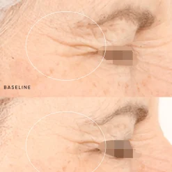 Night Renewal Travel Kit