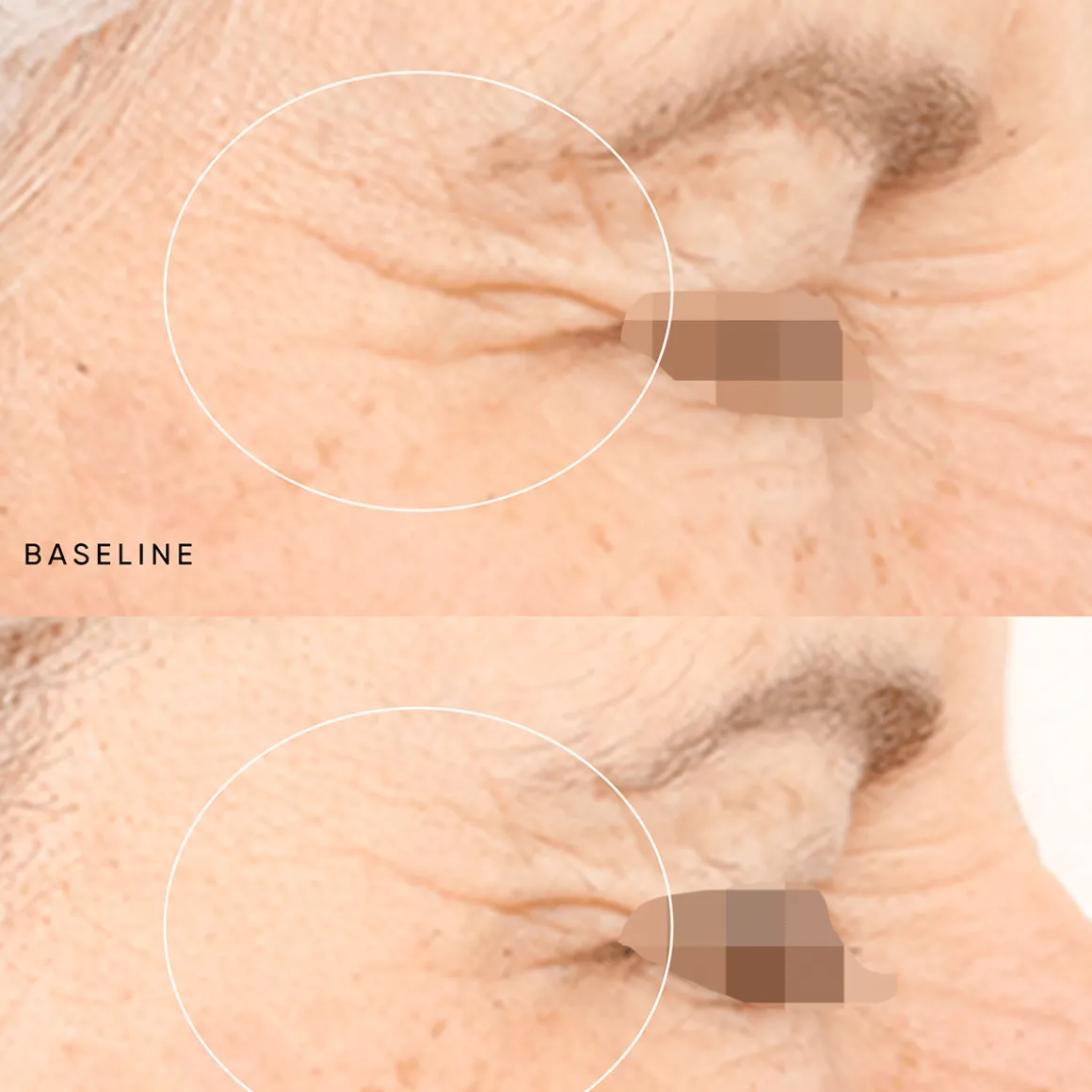 Night Renewal Travel Kit